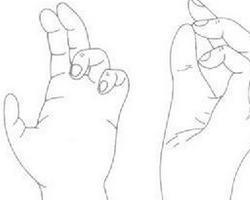 爪形手 猿形手图片