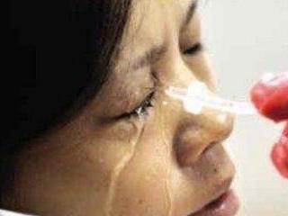 红眼病相关治疗