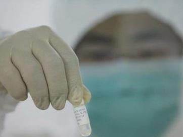 甲型H1N1流感疫苗毒株