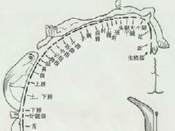 躯体感觉障碍
