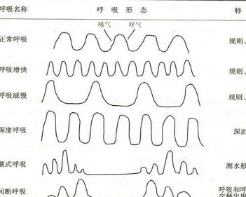 呼吸异常 搜狗百科