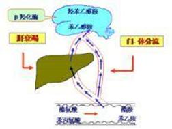 扑翼样震颤