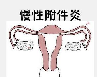 慢性附件炎 - 搜狗百科