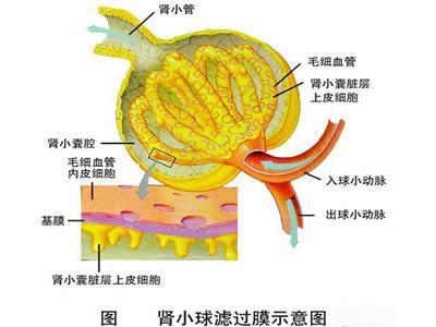微小病变型肾病