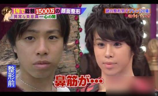 阿伦 日本整形艺人 搜狗百科 阿伦 日本整形艺人 搜狗百科