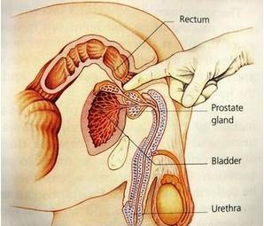 老年人前列腺癌
