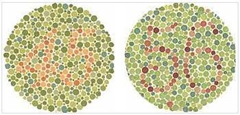 红绿色盲 遗传病 搜狗百科