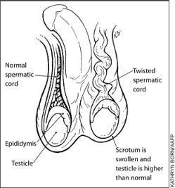 勃起不全は私の関係を台無しにしましたreddit