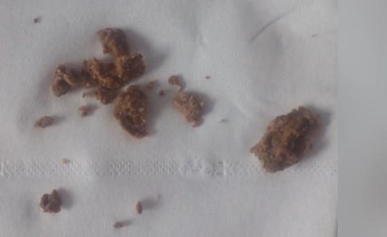 粪便 搜狗百科 粪便 搜狗百科