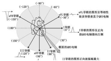 心电轴左偏 搜狗百科