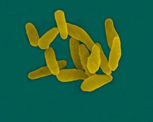 白喉棒状杆菌 最美图片