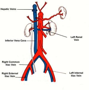 髂外静脉解剖图片