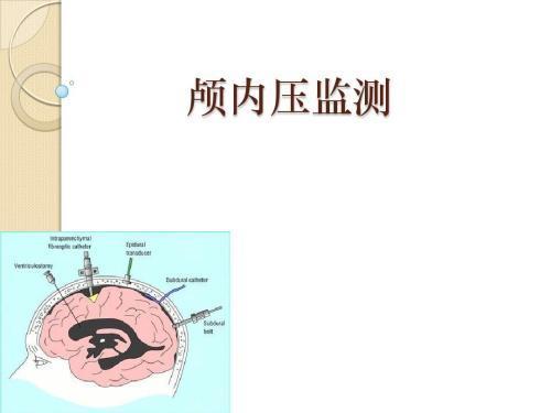 颅内压