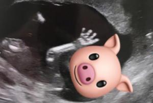 官宣怀孕