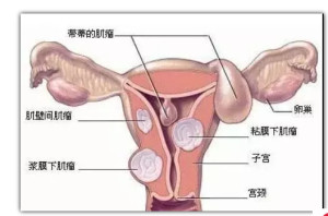 女性生殖系统