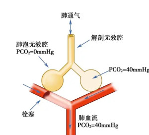 肺通气