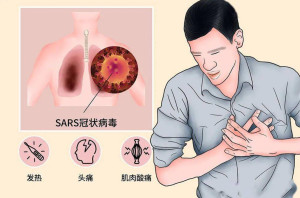 重症急性呼吸综合征