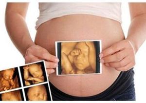 几个月做四维彩超是最佳 300