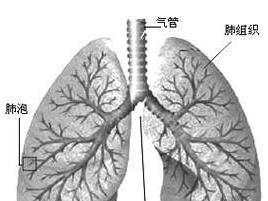 陈旧性肺结核