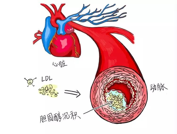 心脑血管