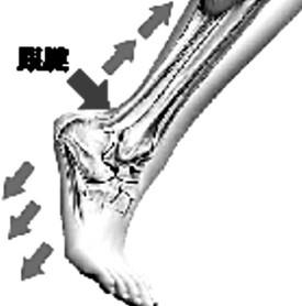 跟腱炎相关图片