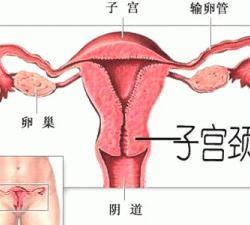 急性子宫颈炎