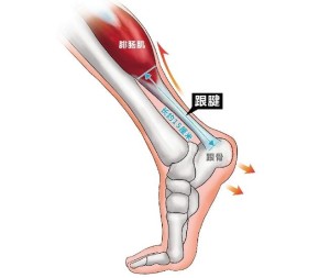 跟腱