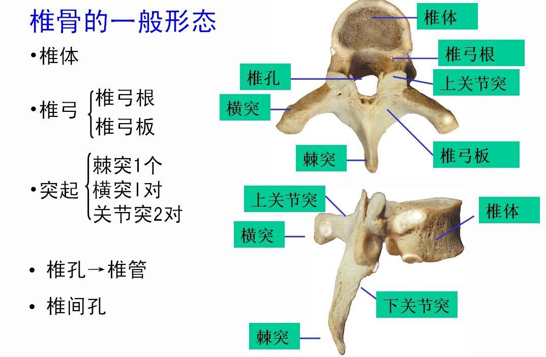 椎体严重楔形变并伴小关节半脱位