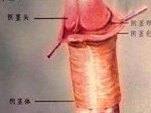 阴茎短小