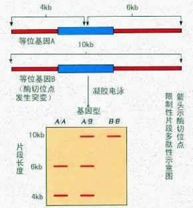 限制性片段长度多态性