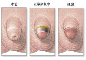 总过程演示图