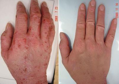 富贵手 搜狗百科