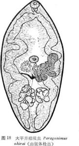 大平并殖吸虫