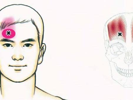 偏头痛 搜狗百科