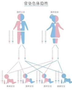 脊髓性肌肉萎缩症