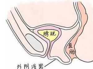 石女外部是啥样的图片