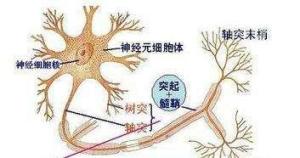 神经炎