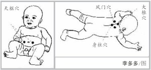 风门穴