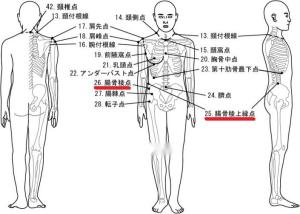 髂嵴点区别于髂嵴最高点