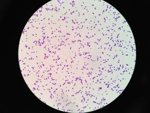 Corynebacterium glutamicum