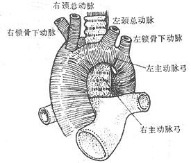 主动脉弓分型图解图片