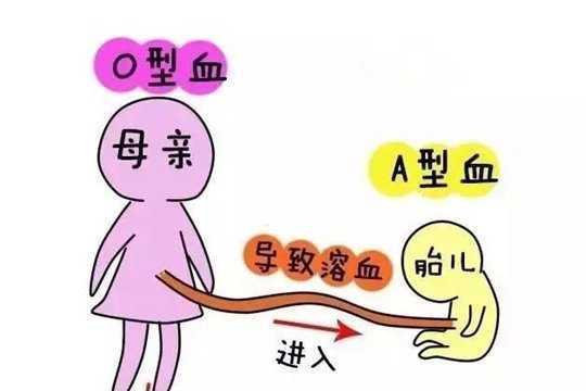 abo溶血