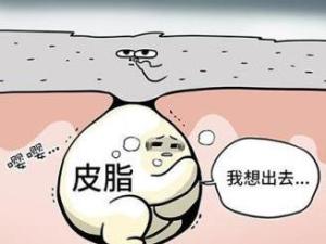闭合性粉刺
