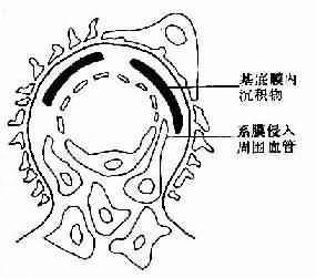 腎小球