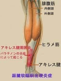 跟腱
