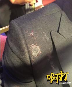泰拳王被爆头鲜血喷射 双方休克进医院