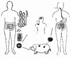 猪肉绦虫猪带绦虫病是由于吃了生的或未煮熟的米猪肉所致, 故询问