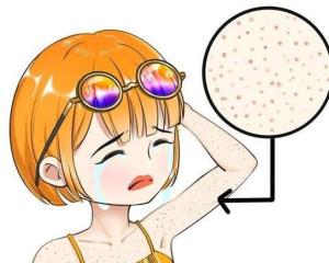 基因鸡皮肤咋回事(鸡皮肤是显性基因吗) 基因鸡皮肤咋回事(鸡皮肤是显性基因吗)