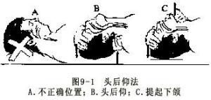 气道通畅