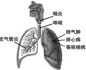 气管炎